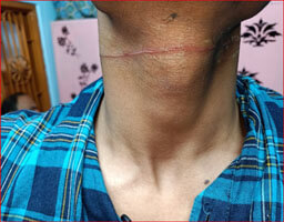 Death is roaming openly on the streets of the city, be careful