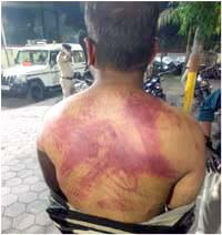 Taking the girl out proved costly, Sahil along with his friends beat her up